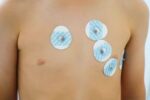 ECG Electrode - Image 2