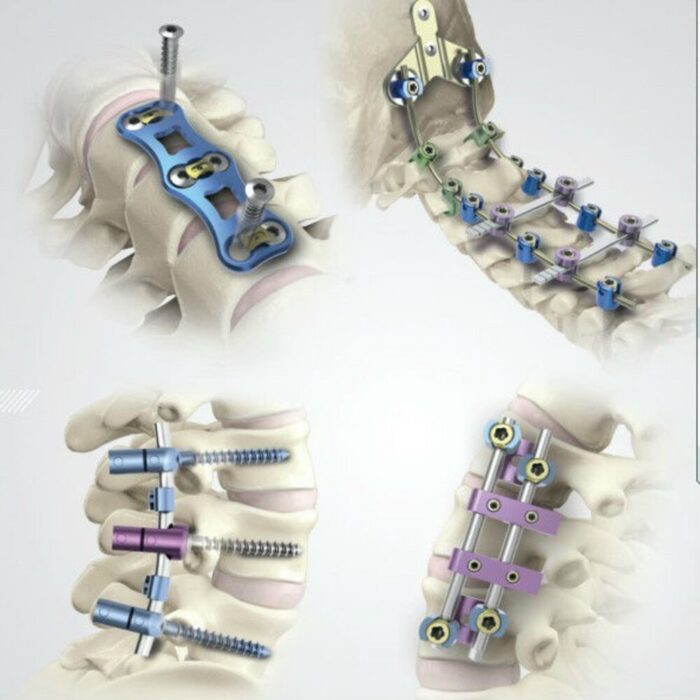 Spinal & Hip Prostheses - Image 3