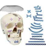 Maxillofacial Titanium Plating System (Mini & Micro)
