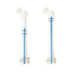 Intramedullary Nails (Tibial & Femoral) - Image 2