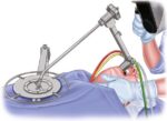 Tekno Germany Flat Operating Laryngoscope – HD Vision & Irritation-Free Performance - Image 3